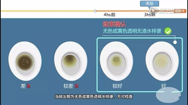 排泄物颜色.jpg